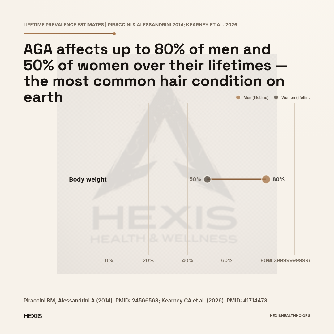 Dumbbell chart comparing lifetime prevalence of androgenetic alopecia: up to 80% in men versus up to 50% in women, showing how common pattern hair loss is regardless of testosterone levels